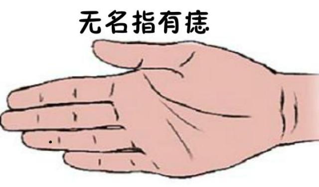 无名指有痣 无名指相学中代表的是配偶异性,若是痣在无名指的人,做事