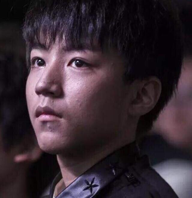 青春期的王俊凯,满脸爆粉刺青春痘,这会不会长残