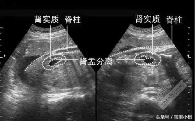 哪四个字生男孩? 一样寻常孕期到22-29周之后就要举行排畸四维搜寻了.