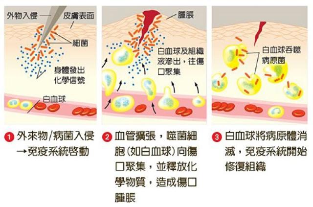 首先是变质,比如细胞水肿,坏死等.