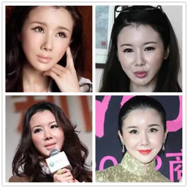 整形脸vs原装脸,40岁以后再看,效果亮瞎眼