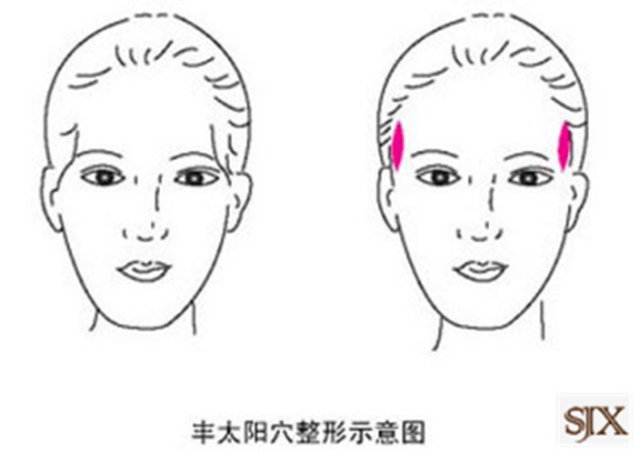 cbee1041bf7f40e6b9248a571481dc35.jpeg