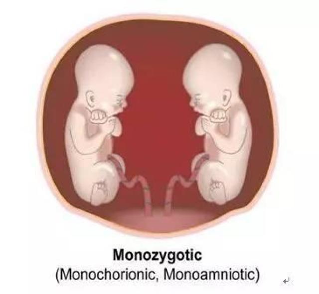 单绒毛膜单羊膜囊双胎(mcma):受精卵分裂发生在受精后8～13天,由于