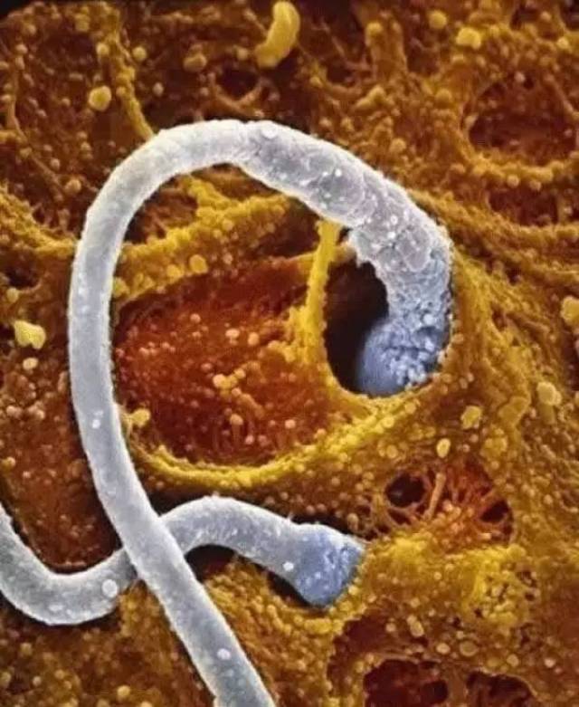 这个精子会和卵子成功相遇吗?