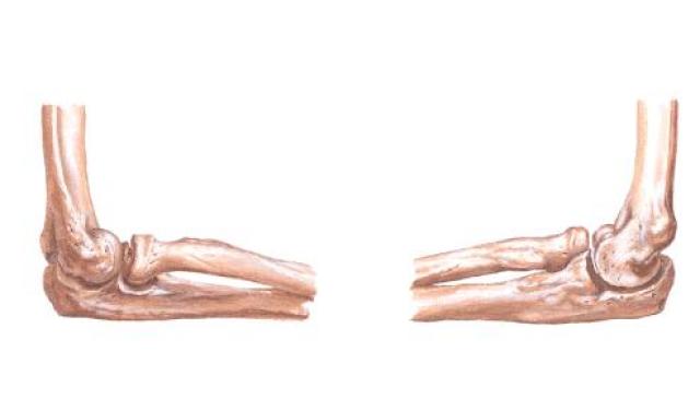 正常人体解剖学 认识自己人体六大关节之肘关节