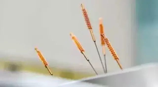 最古老的针疗法:一针见效,不用看病吃药!