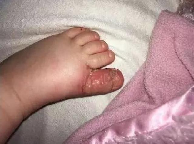 婴儿几个月会吃脚呢 2e9d88310d55464ca18e9a5831c90145.jpeg