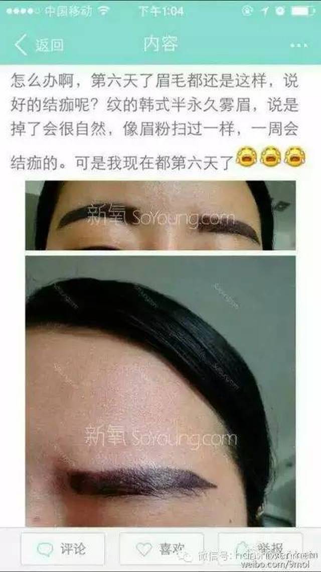 又一位美女惨遭所谓的"韩式半永久纹眉"的毒手,试问是哪位大师啊,把