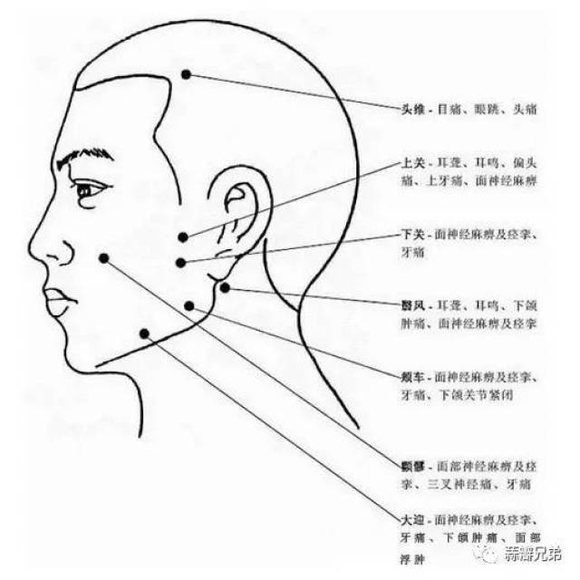 痉挛,牙痛 翳风穴:治疗耳聋,耳鸣,下颌肿痛,面神经麻痹及痉挛 颊车穴