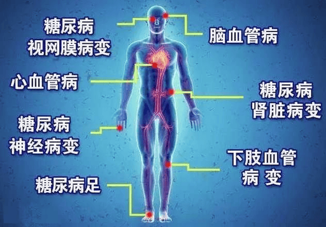 出现这些信号,糖尿病要一定要测是否有并发症了!
