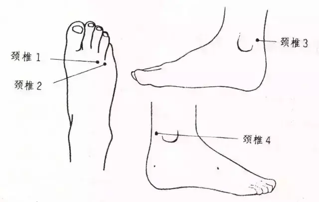 除了颈椎的脖子,还有"手颈","脚颈",也可以叫做"手脖子,脚脖子",其实