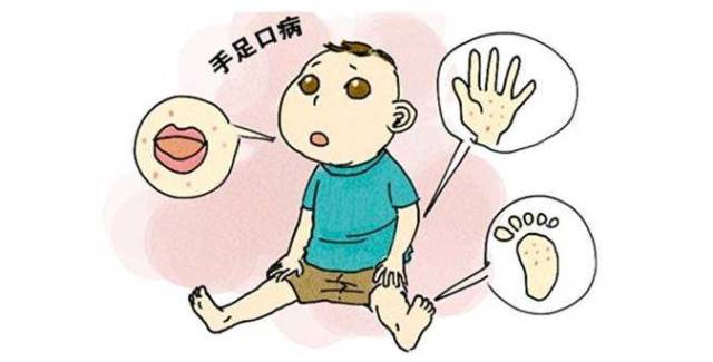 怎么看小孩有没有患过水痘 e57d8ae0c4fc407db639e521b4376292.jpeg