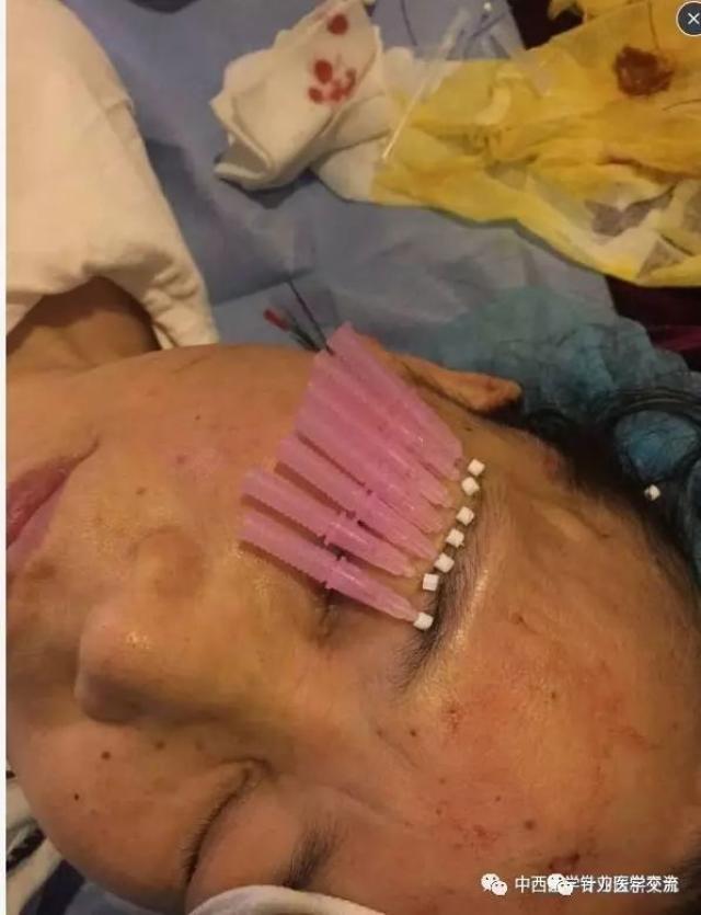 线雕:三个视频看懂,惊呆了!
