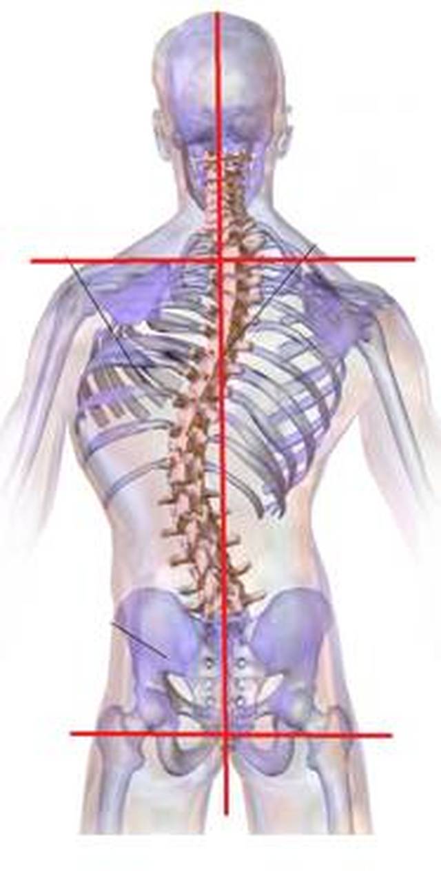 正常脊柱解剖形状,垂直于中垂线上