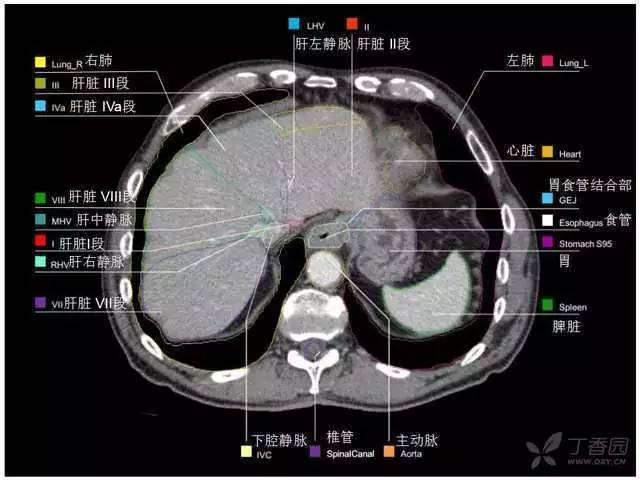 掌握这篇解剖,晋级腹部ct影像诊断高手(精细版)