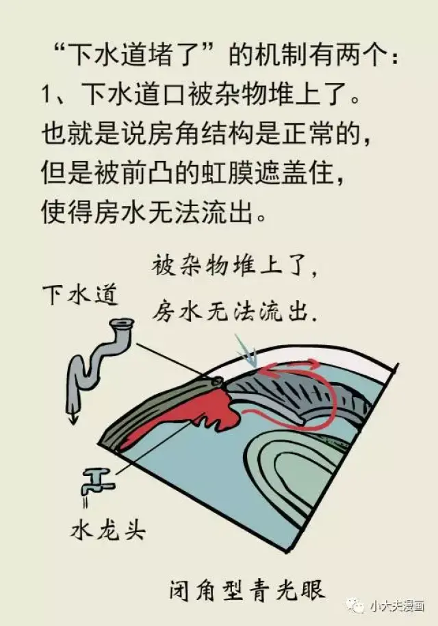 瑞昂生命|关灯看手机,小心"青光眼"致失明