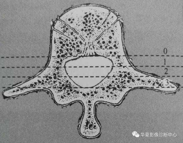 脊柱骨性损伤的这些细节,你都描述了吗?