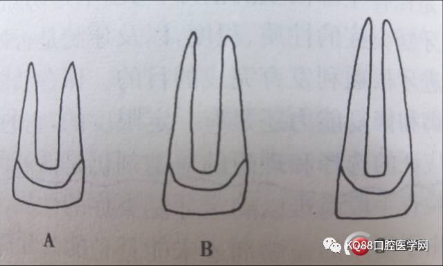 牙根停止发育的年轻恒牙所以引发的潜在危害—— 1.