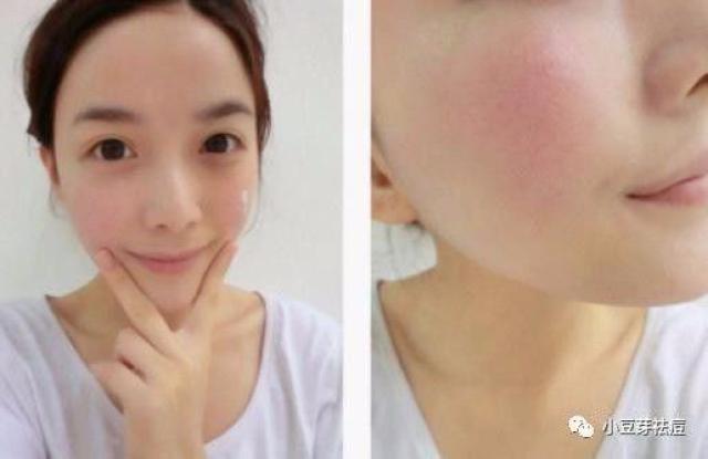 怎样可以祛痘土方法 2bf8fa61e1474e5999e10a8a706cacc9.jpeg