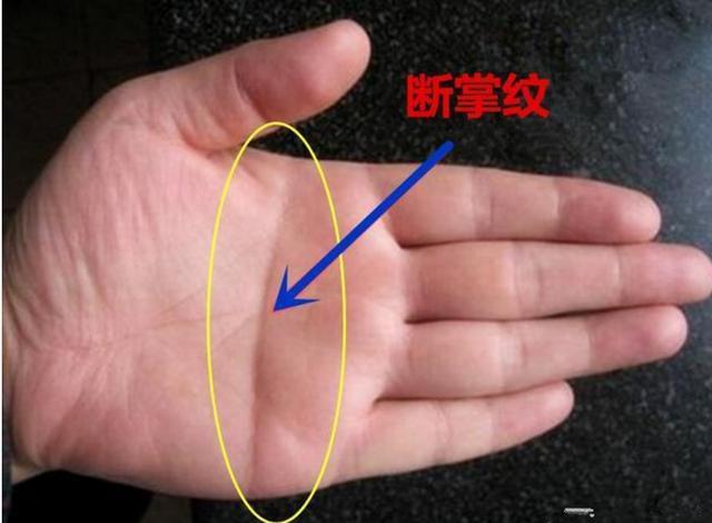 一只手是断掌纹称为单手断掌纹,两只手是断掌纹称为双手断掌纹