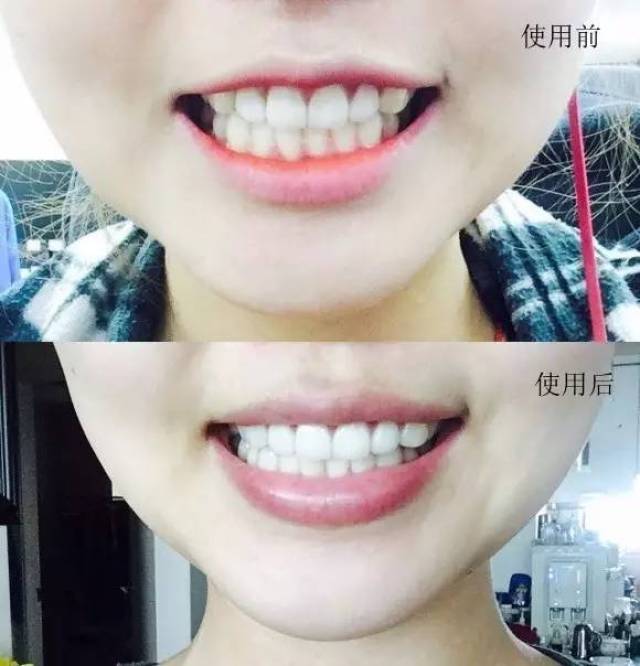 美美的 白白的 好迷人 口腔健康的标准是 牙齿清洁,色泽美白 没有蛀牙
