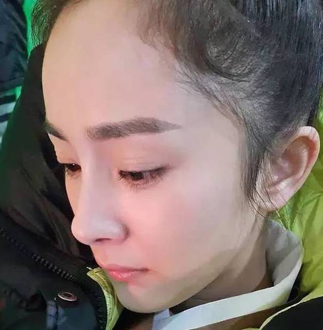 起床发现半床头发】原来第一批来澳洲的90后已经秃了!