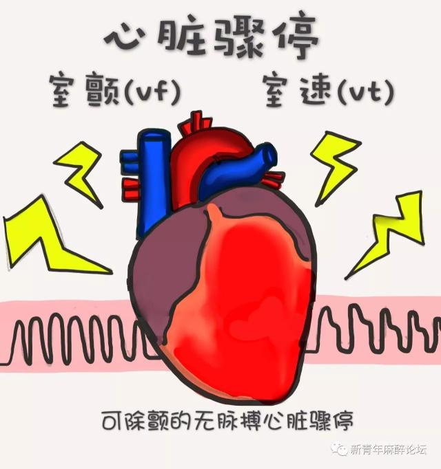 10,心脏骤停