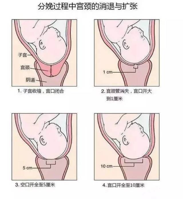 1,开指=开宫口 开宫口,又称子宫颈口扩张.