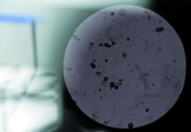 中山网新闻,市民从显微镜里看到的自来水细菌