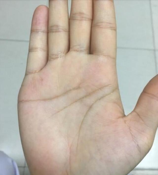 贫病交加,很难有积蓄 活得很辛苦的女人手相