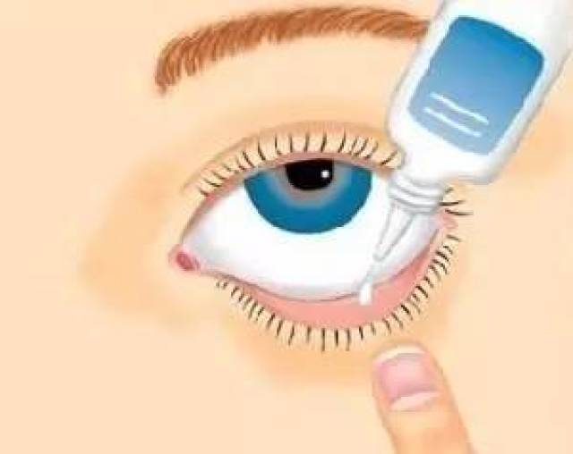 罗岩 许多患者滴眼药水时常对着黑眼球(角膜),这是不正确的