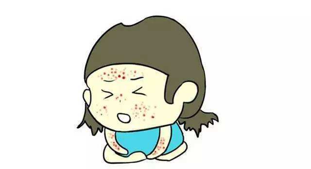 "水痘病毒传染性非常强,儿童接触后90%可发病.