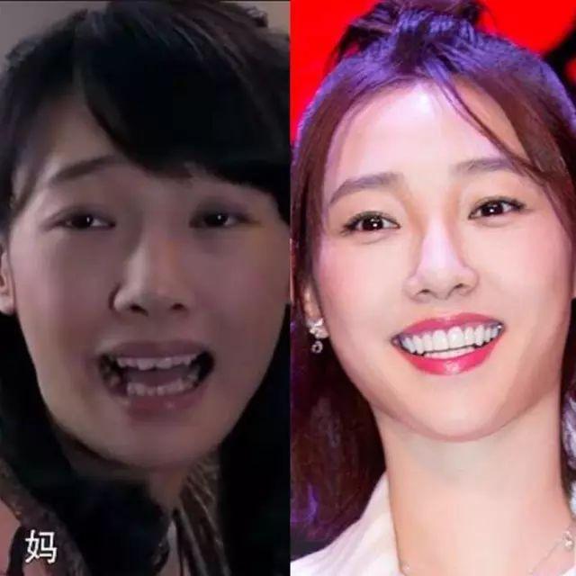 娱乐圈都快被假牙霸占了!