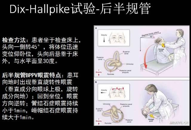 专业分享 | 耳石症复位疗法权威专家肖立智主任课程内容精彩回顾