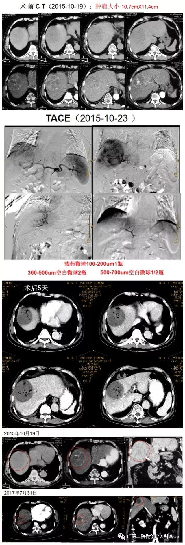 粗瘟品桨附樯埽焊没颊咧琢鼍薮螅灶血供丰