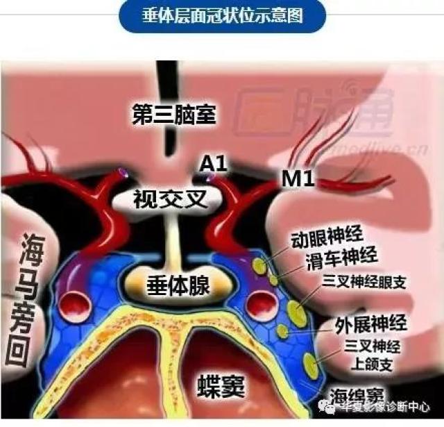 脑部断层 内囊 willis环 前联合 垂体 海马:清晰解剖图谱