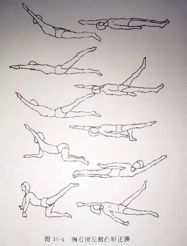 (一)矫正体操  以下是胸左腰右侧凸时的矫正体操见图30-4