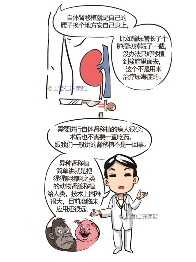 肾移植,不仅仅是一个手术!