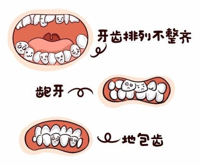 常手指放在上下牙齿间,时间长了就会让牙齿外突上下牙无法对齐咬合