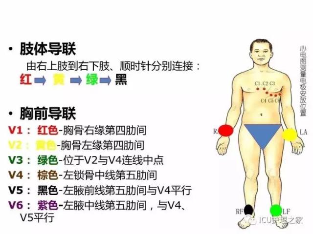 心电图机的操作,12导联,18导联链接详解!