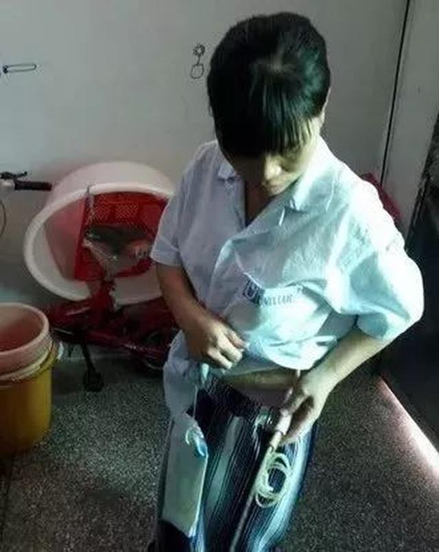 出院近一个月,身上还挂着药水袋