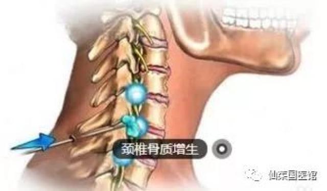 颈椎疼腰椎间盘突出 中医小针刀显奇效 ——名老中医徐荣海医案