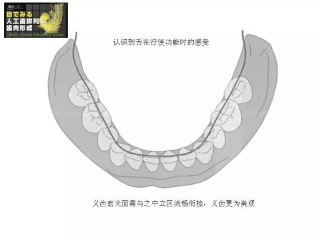 胡常红:全口义齿光滑面成型(本科技术班课程系列)