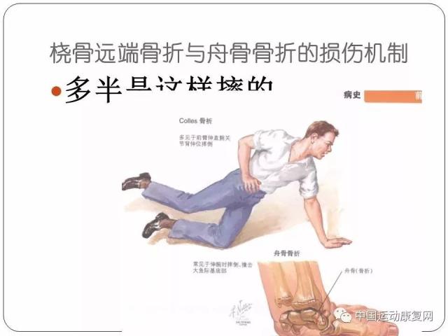 【动图示范】手腕运动损伤及康复训练