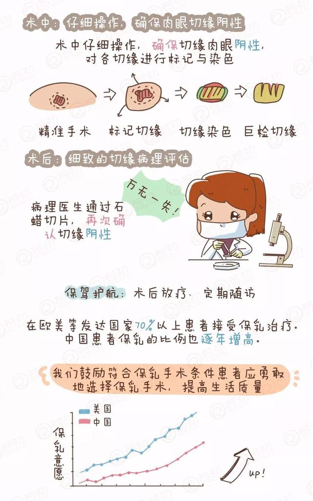 保乳手术可以在达到 相同手术效果的前提下,提高患者术后生活质量