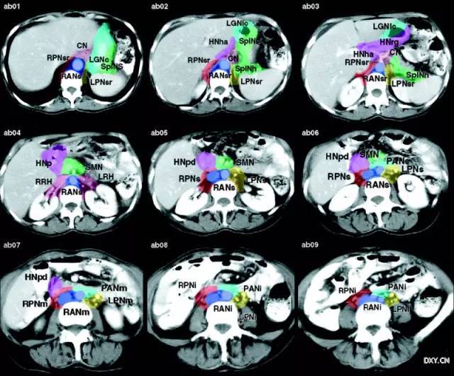 肿瘤医生必看:全身各区域淋巴结 ct 图谱