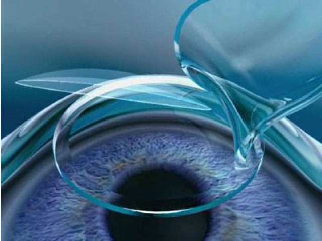 近视激光手术是基于人的眼角膜进行的手术,因此术前必须通过严格的