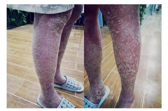 皮肤有责的个人展示页