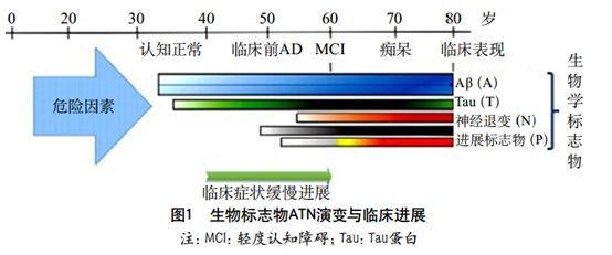 阿尔茨海默病的ATN诊断标准重塑血管性认知障碍诊治-搜狐大视野-搜狐新闻