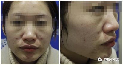 说说你做过最管用的医美项目是什么?|日本医美-搜狐大视野-搜狐新闻